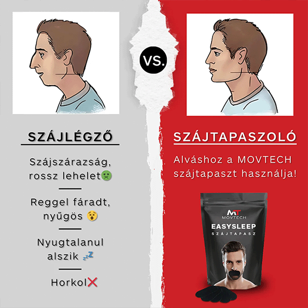 Movtech™ Easy Sleep Szájtapasz