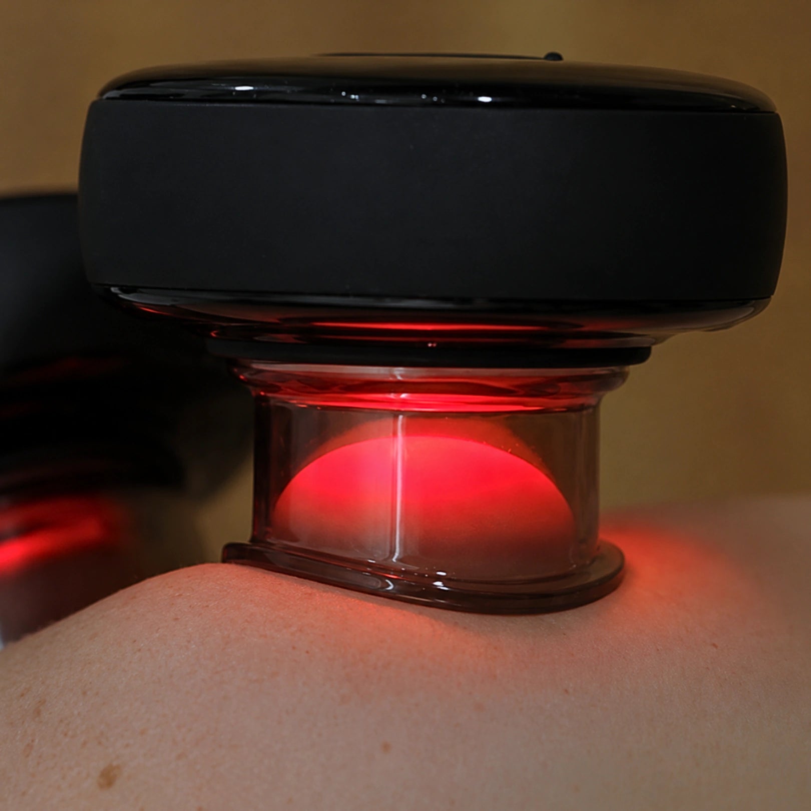 Movtech Smart Cupper okos köpölyöző közelről a bőrön, vörösfényes üzemmódban
