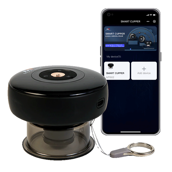 Movtech™ Smart Cupper - Okos Köpölyöző - MovTech